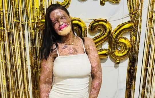 Influenciadora Káh Felipe morre aos 36 anos após batalha contra doença rara e câncer