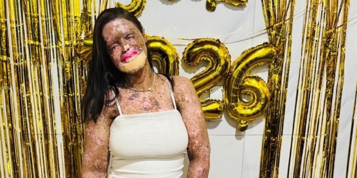 Influenciadora Káh Felipe morre aos 36 anos após batalha contra doença rara e câncer