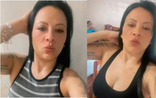 Mulher morre após complicação durante colonoscopia de rotina em hospital de São Paulo