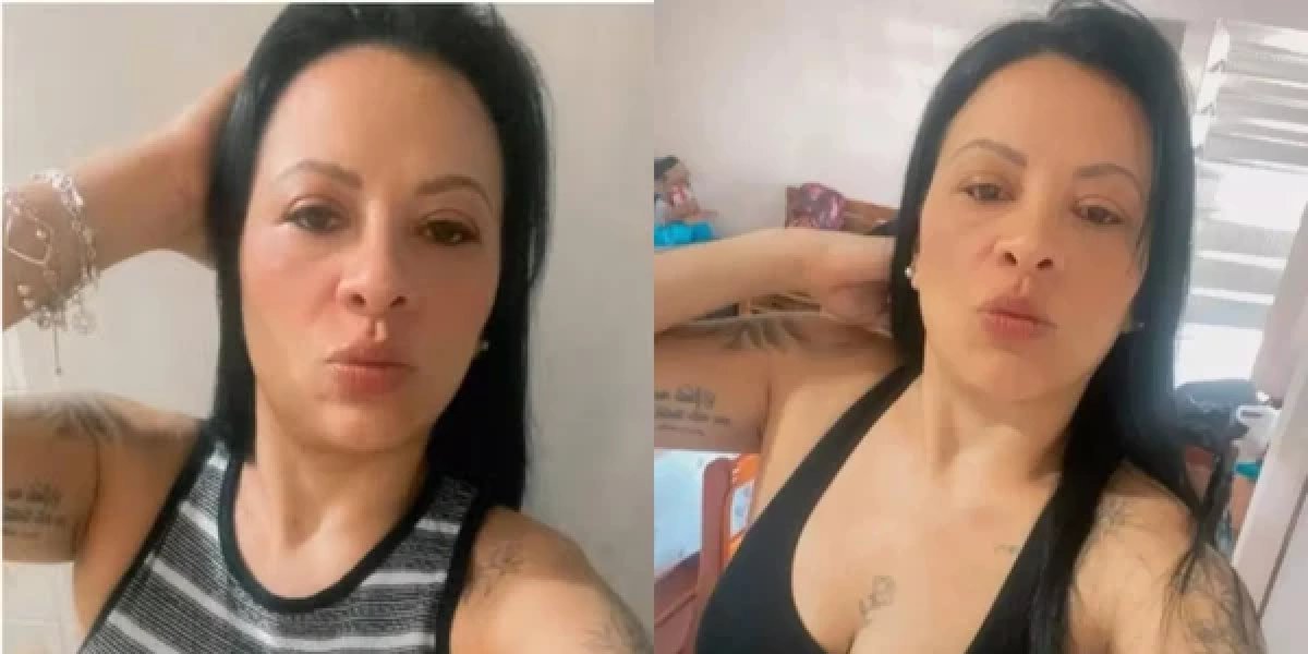 Mulher morre após complicação durante colonoscopia de rotina em hospital de São Paulo