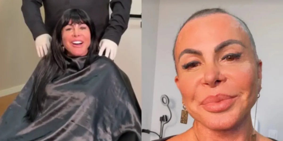 Gretchen raspa a cabeça em live antes de transplante capilar