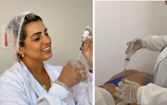 Falsa médica é presa após suposto uso de silicone de construção em harmonização de glúteos