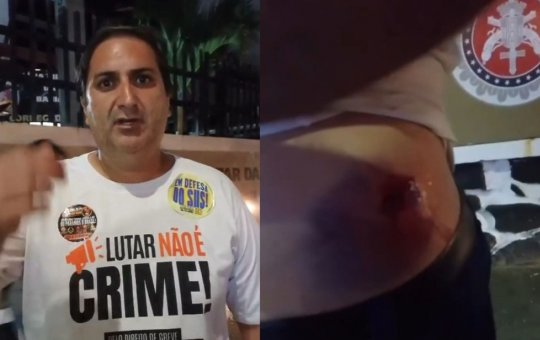 Candidato ao Governo da Bahia, Aroldo Félix é atingido por bala de borracha durante protesto em Salvador