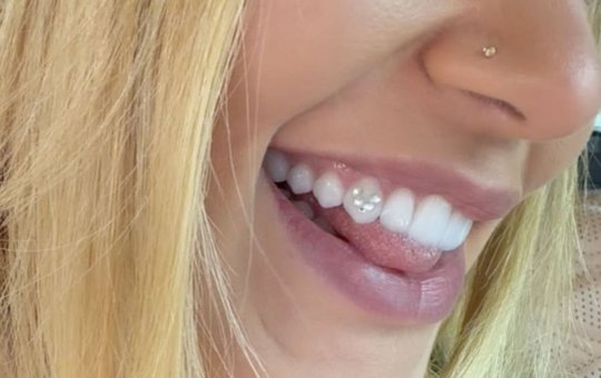 Homenagem a Vini Jr.? Virginia coloca piercing com a letra V no dente: 'Achei muito lindo'