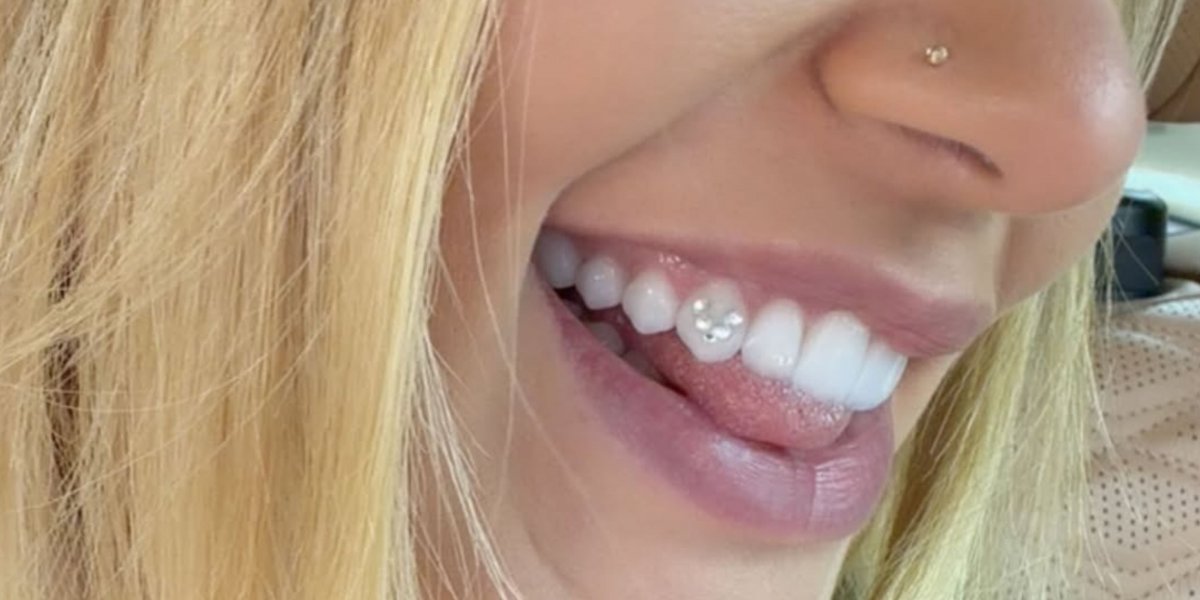 Homenagem a Vini Jr.? Virginia coloca piercing com a letra V no dente: 'Achei muito lindo'