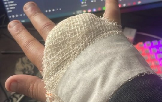 Streamer perde dedo ao tentar acessar área restrita do Rock in Rio
