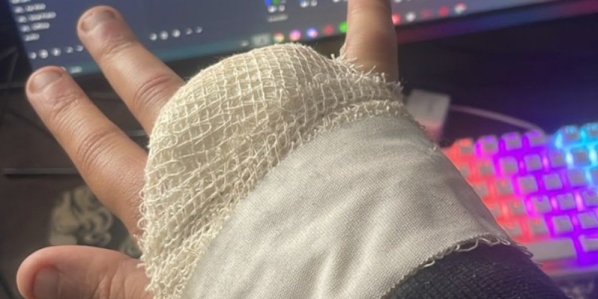 Streamer perde dedo ao tentar acessar área restrita do Rock in Rio