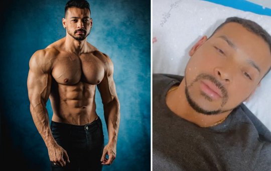 O vereador e fisiculturista Felipe Franco estoura apêndice e passa por cirurgia