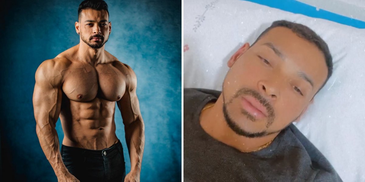 O vereador e fisiculturista Felipe Franco estoura apêndice e passa por cirurgia