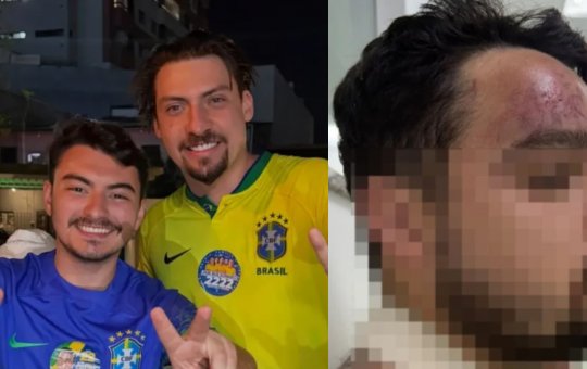 Assessor de Jair Renan é investigado por agredir primo com garrafadas em Florianópolis