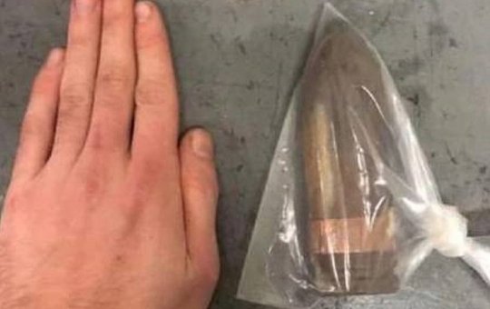 Saiu pela culatra: Inglês é atendido com projétil de canhão no ânus