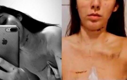 Jovem que acusa Clayson de agressão posta fotos e desabafo nas redes sociais