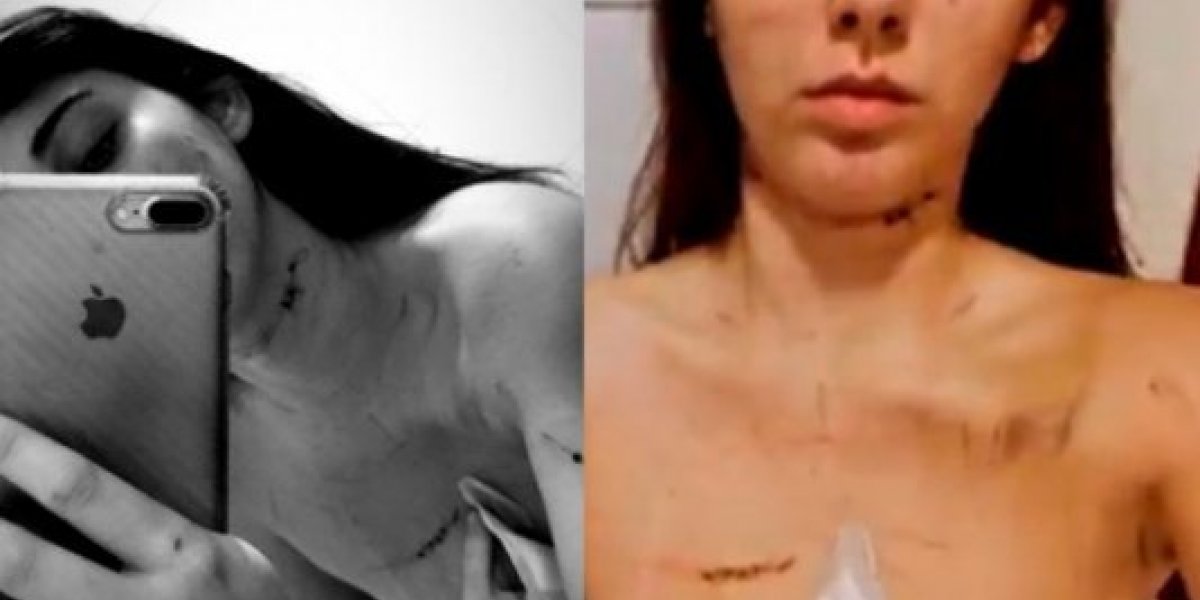 Jovem que acusa Clayson de agressão posta fotos e desabafo nas redes sociais